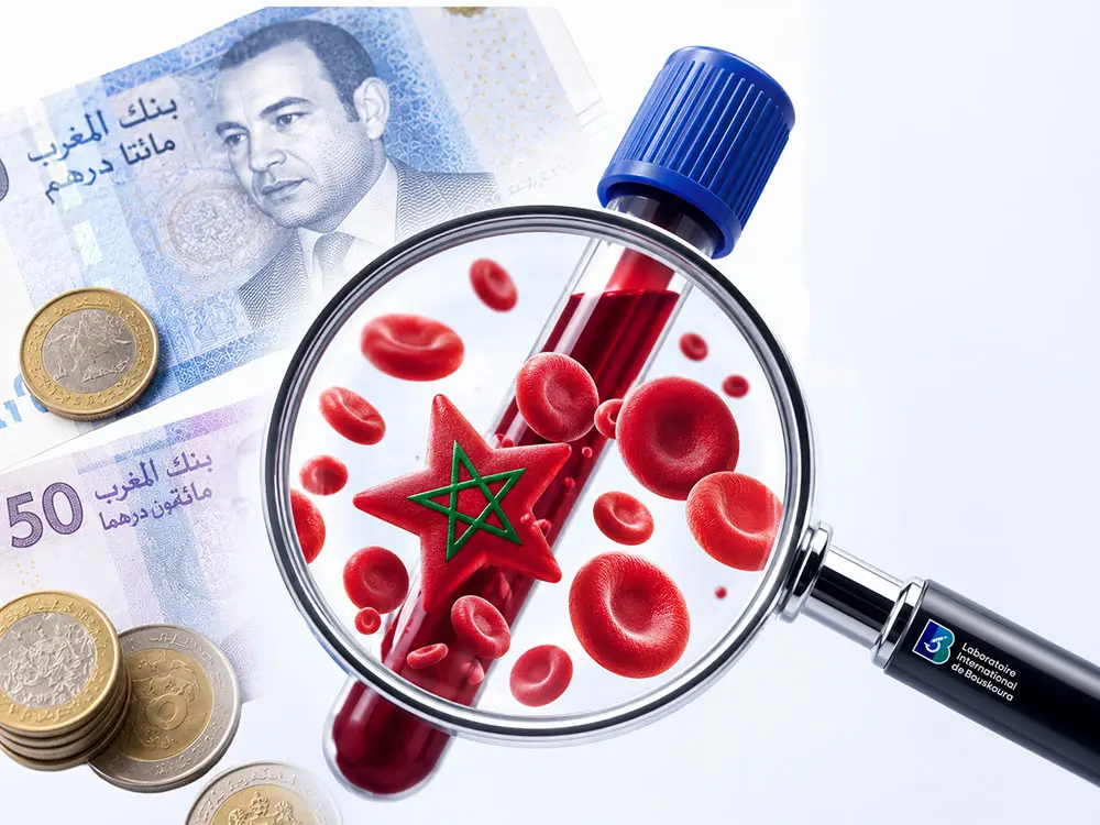 prix-prise-de-sang-maroc-laboratoire-bouskoura